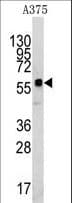 KREMEN1 / KREMEN-1 Antibody (aa53-82)