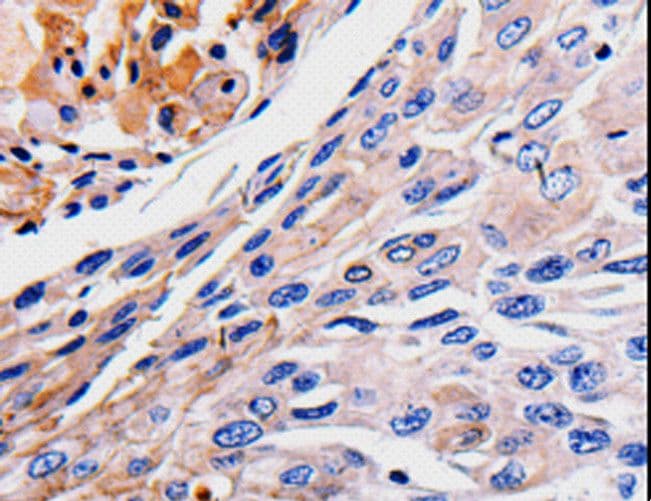 RAB41 Antibody