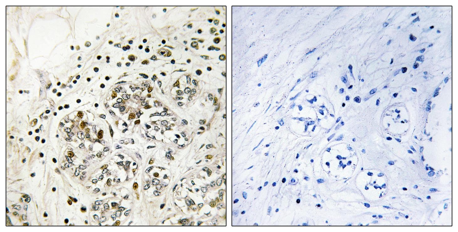 NFKBIA / IKB Alpha / IKBA Antibody (phospho-Ser32/Ser36)