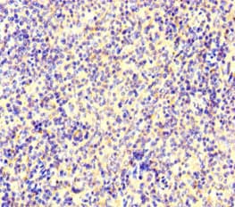 IKZF1 / IKAROS Antibody