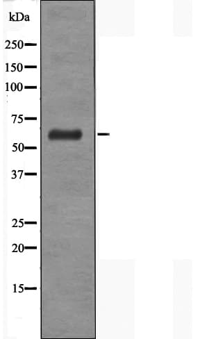 FCAR / CD89 Antibody