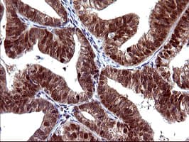 UPRT Antibody (clone OTI1A3)