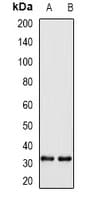 WBSCR22 Antibody