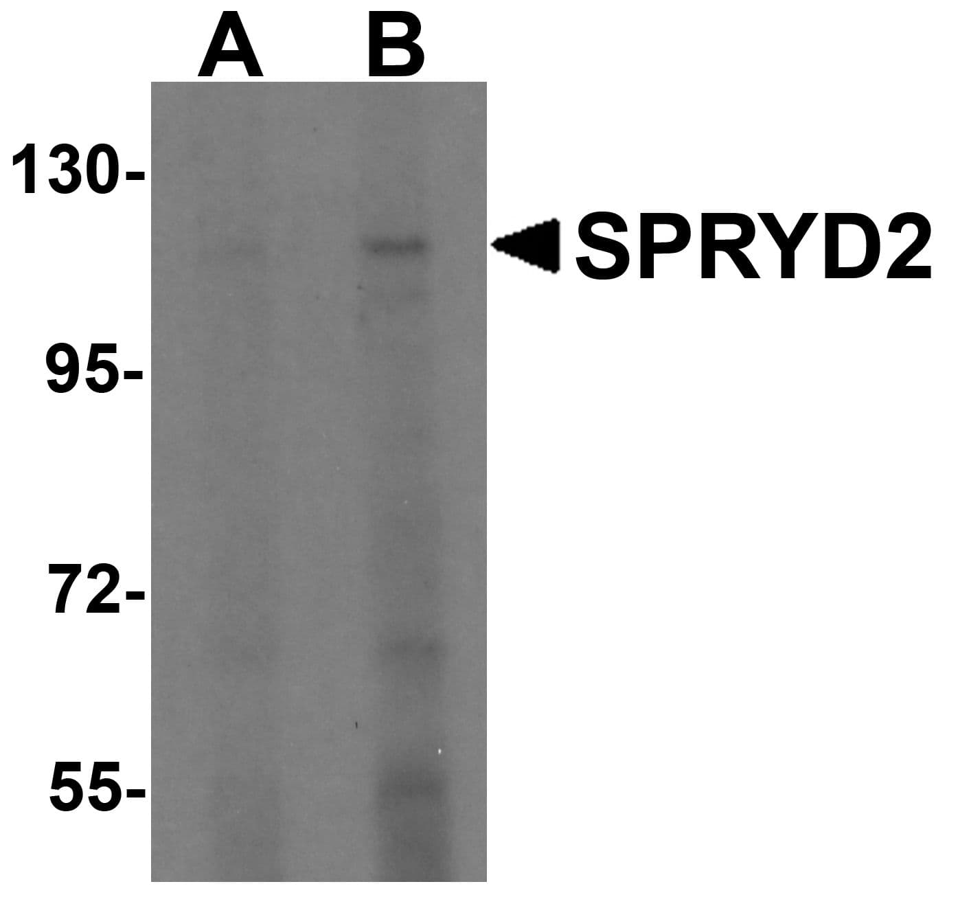 CMYA5 Antibody