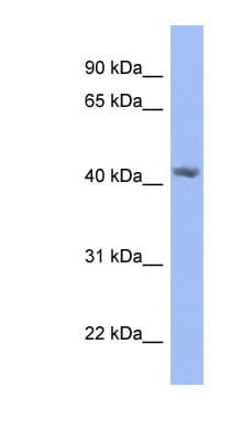PRPSAP2 Antibody (N-Terminus)