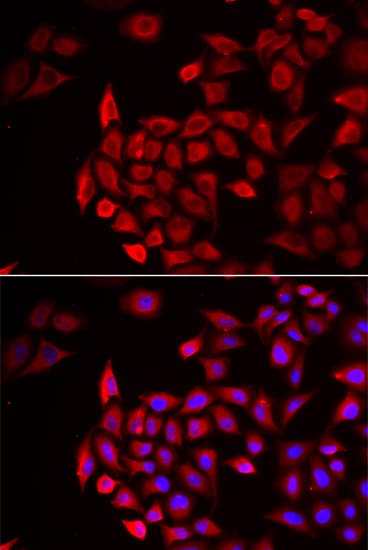 Cochlin / COCH Antibody