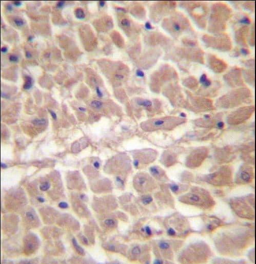 Polyclonal Rabbit anti-Human TRIM11 Antibody (aa300-329, IHC, WB)