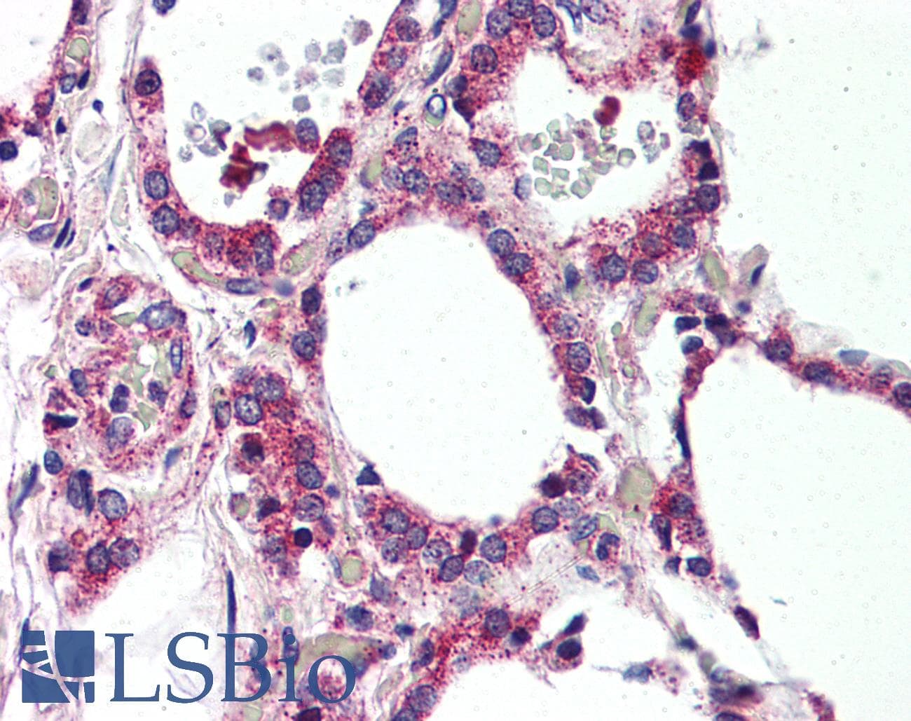 IHC-plus™ Polyclonal Rabbit anti-Human MRGPRF Antibody (N-Terminus, IHC)