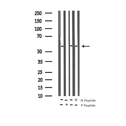 Polyclonal Rabbit anti-Human DOK1 Antibody (phospho-Tyr362, IF, WB)