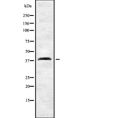CNR2 / CB2 Antibody