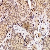 UEVLD Antibody