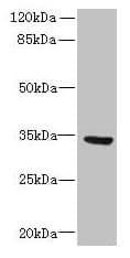 SLC25A18 Antibody