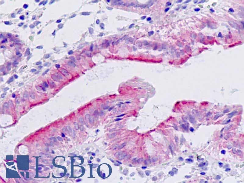 IHC-plus™ PRKCQ / PKC-Theta Antibody (aa643-692)