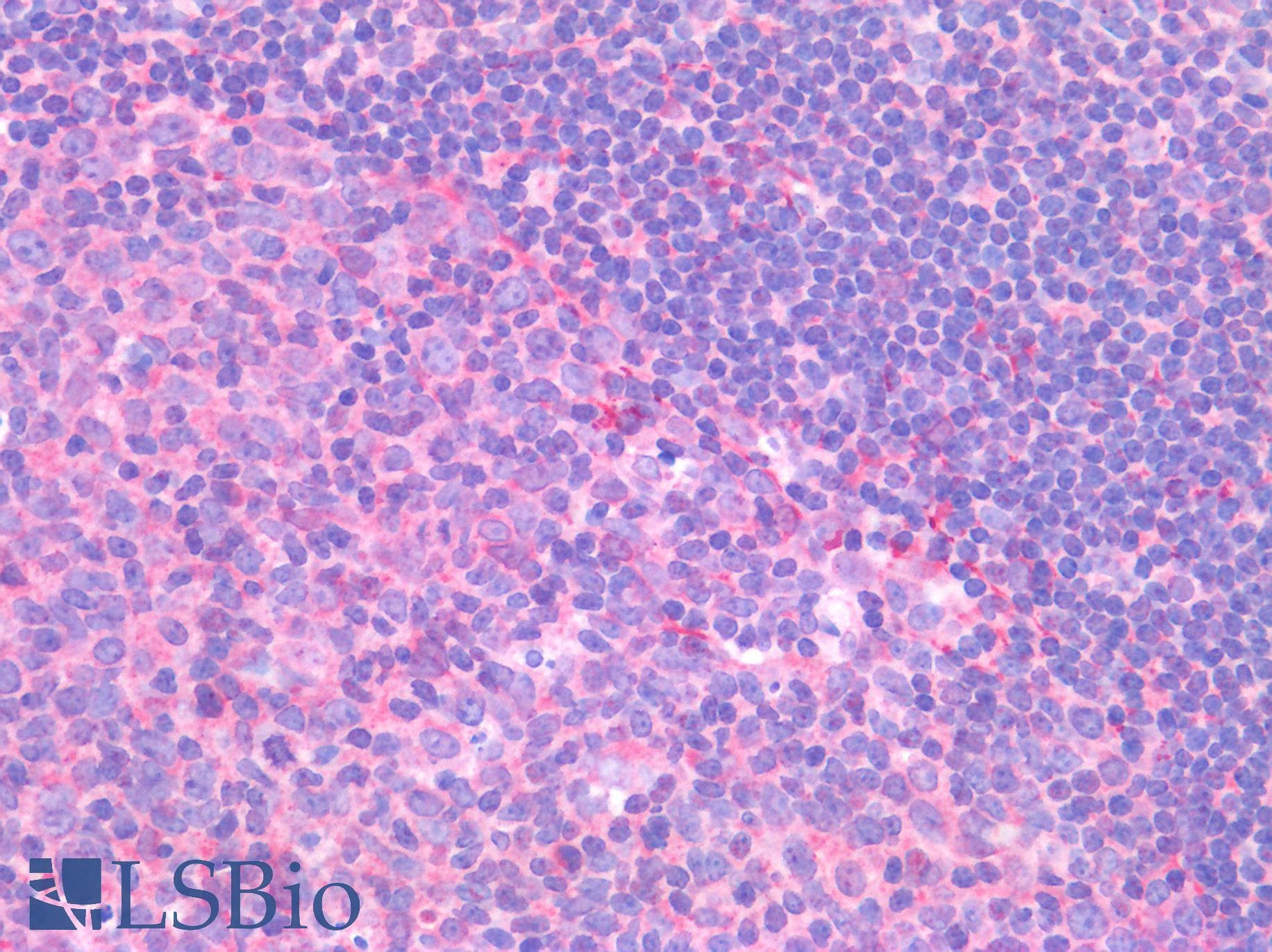 IHC-plus™ Polyclonal Rabbit anti-Human TP53 / p53 Antibody (IHC)