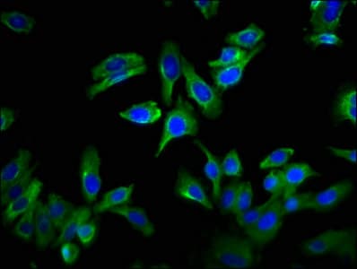 Polyclonal Rabbit anti-Human GPRC6A Antibody (IHC)