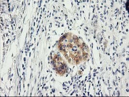 ILVBL Antibody (clone OTI1A12)