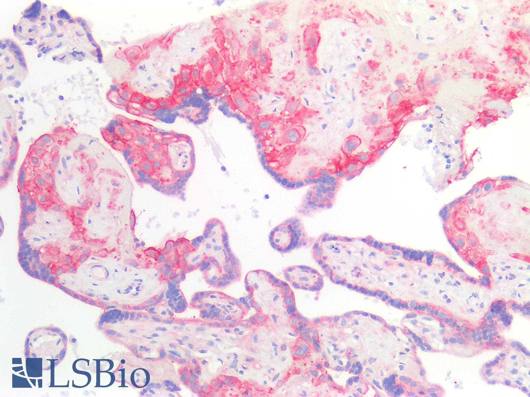 PathPlus™ Polyclonal Rabbit anti-Human CD276 / B7-H3 Antibody (aa47-219, IHC, WB)