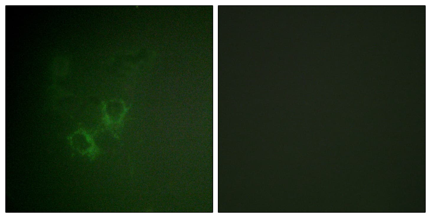IHC-plus™ Polyclonal Rabbit anti-Human AHR Antibody (aa2-51, IHC, IF, WB)