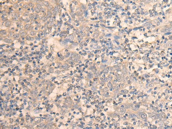 DAZ1 / DAZ Antibody