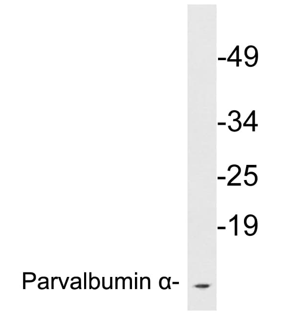 IHC-plus™ PVALB / Parvalbumin Antibody (aa51-100)