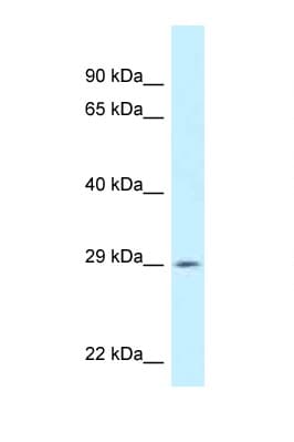 Polyclonal Rabbit anti-Human SPIC Antibody (aa148-197, WB)