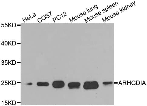 ARHGDIA / RHOGDI Antibody