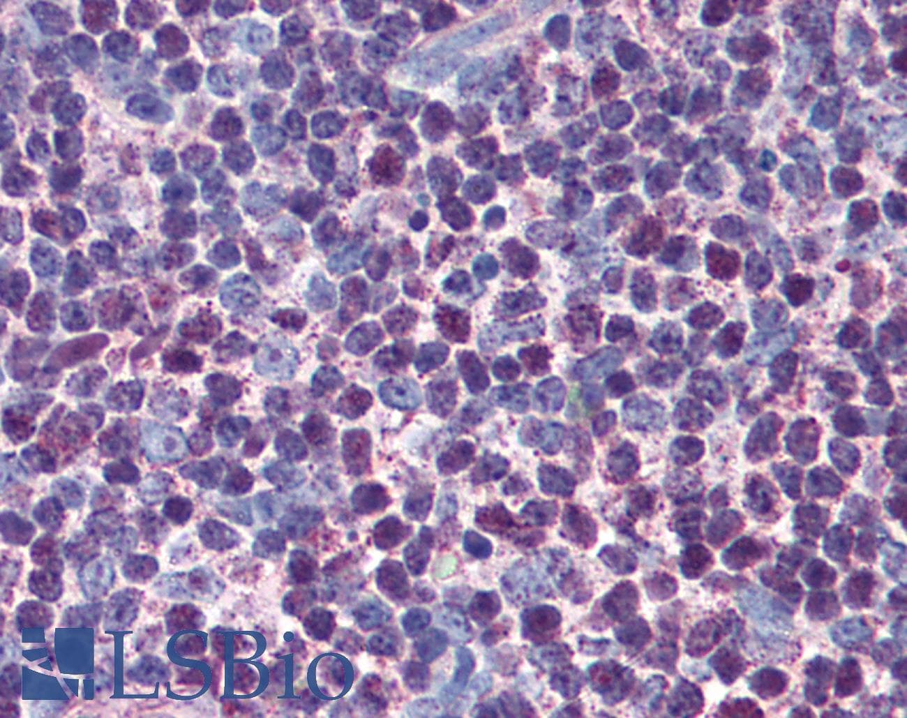 IHC-plus™ CASP3 / Caspase 3 Antibody (clone 31A1067)