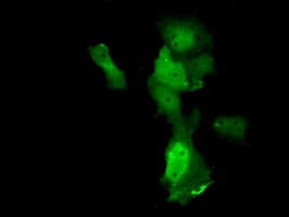 ANXA11 / Annexin XI Antibody (clone OTI1C6)
