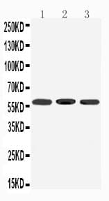 Polyclonal Rabbit anti-Mouse DRD5 / Dopamine Receptor D5 Antibody (aa388-407, WB)