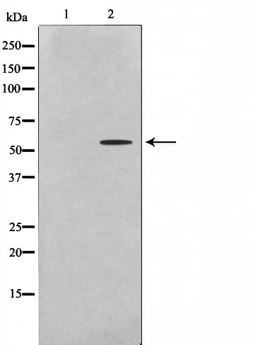 YTHDF1 Antibody