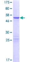 Human ZC4H2 Protein (Recombinant GST)