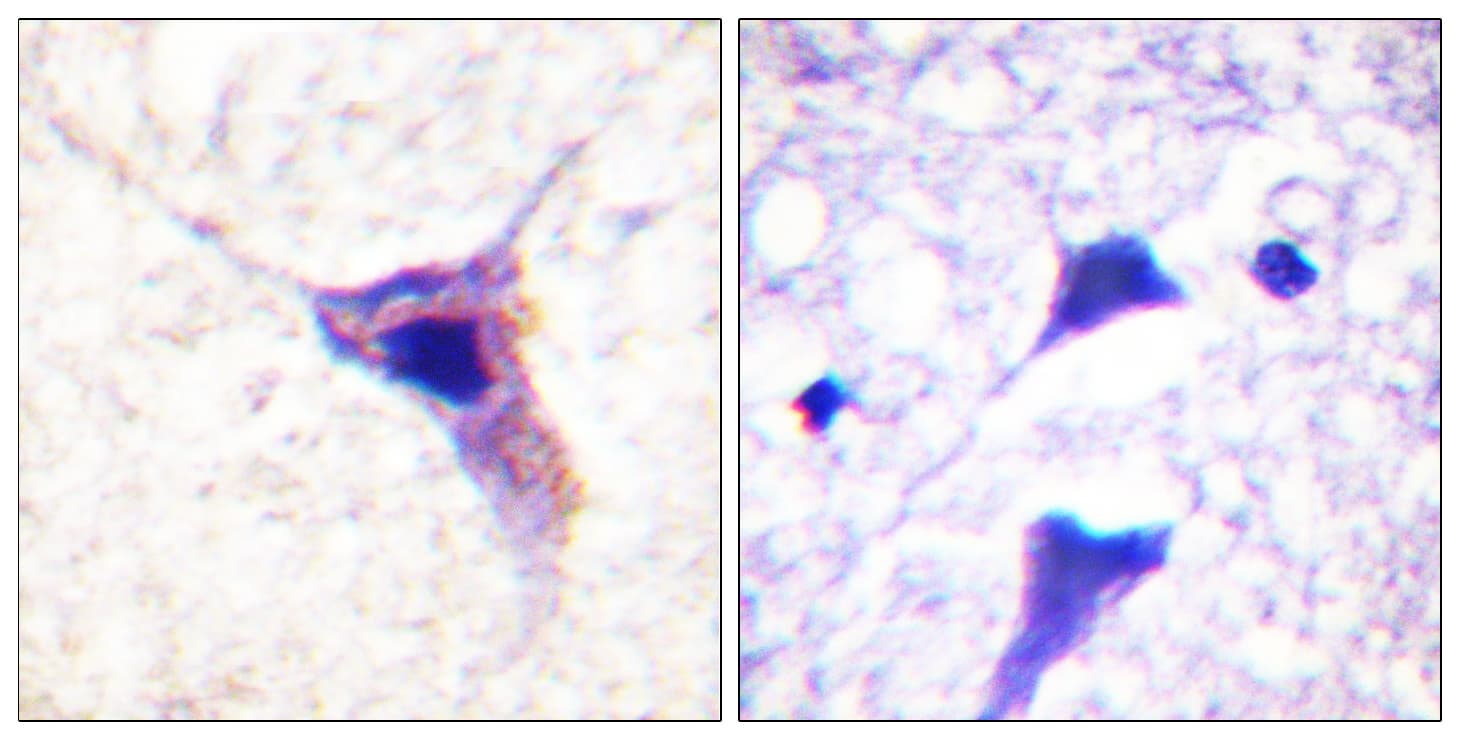 SYN1 / Synapsin 1 Antibody (phospho-Ser62)