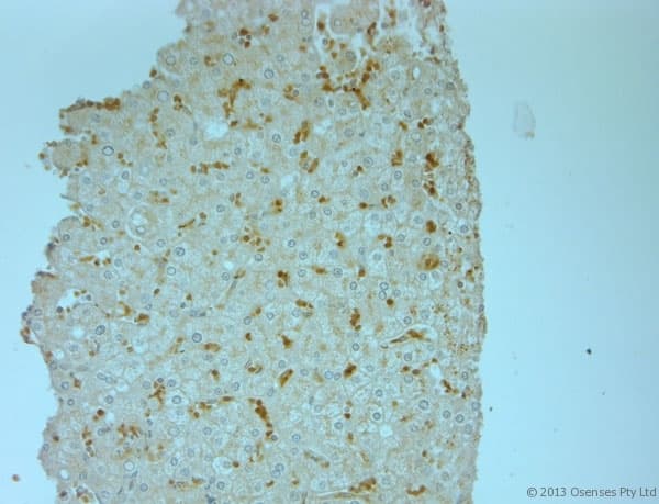 Polyclonal Rabbit anti-Human ERK1 + ERK2 Antibody (phospho-Thr202/Tyr204, IHC, WB)