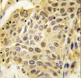 Polyclonal Rabbit anti-Human SENP5 Antibody (aa524-555, IHC, WB)