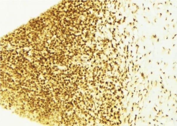 CDKN1B / p27 Kip1 Antibody (phospho-Thr187)