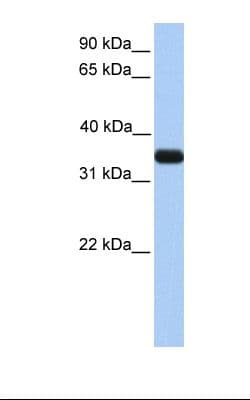 PathPlus™ Polyclonal Rabbit anti-Human APOE / Apolipoprotein E Antibody (N-Terminus, IHC, WB)