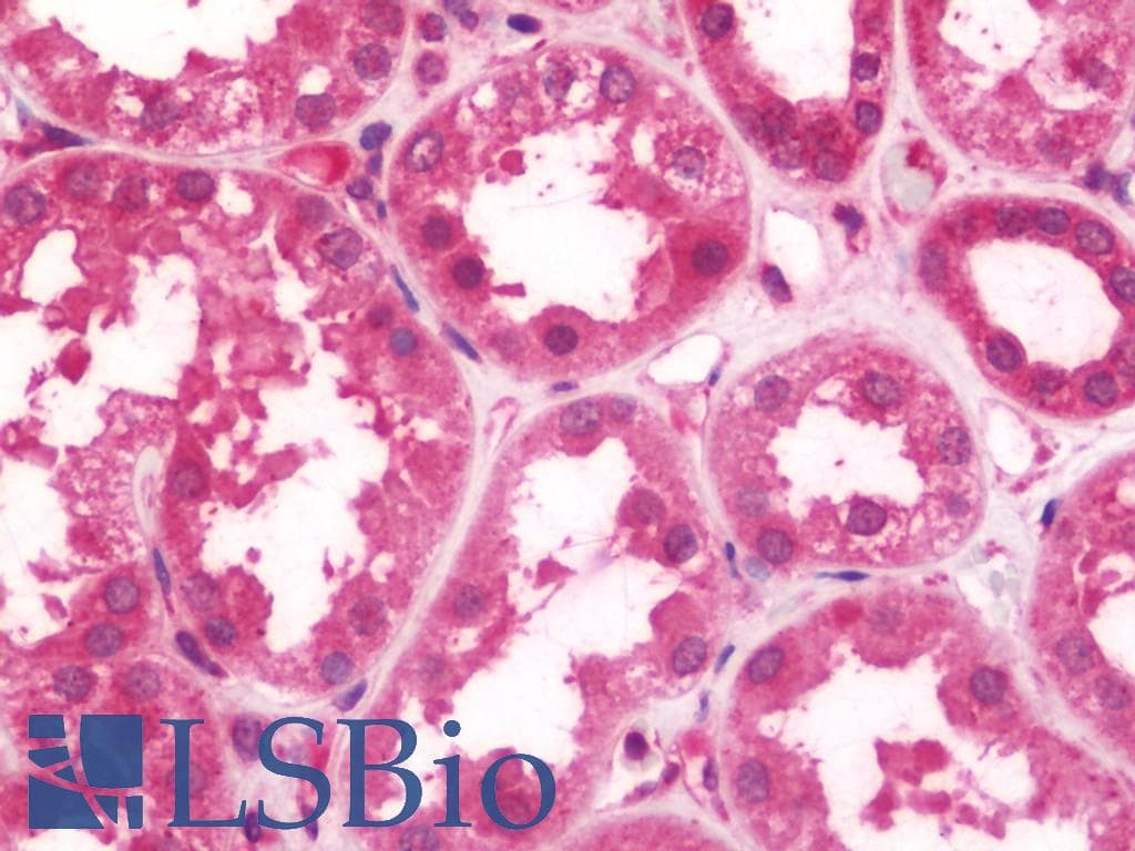 IHC-plus™ FHL5 Antibody (aa1-226)