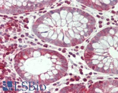 IHC-plus™ STMN1 / Stathmin / LAG Antibody (aa9-58)