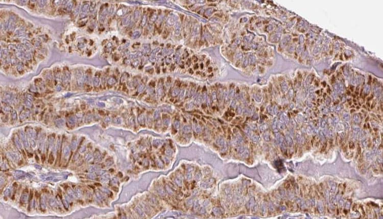 TSH Receptor / TSHR Antibody
