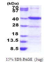 Human ANKRA2 / ANKRA Protein (Recombinant His)