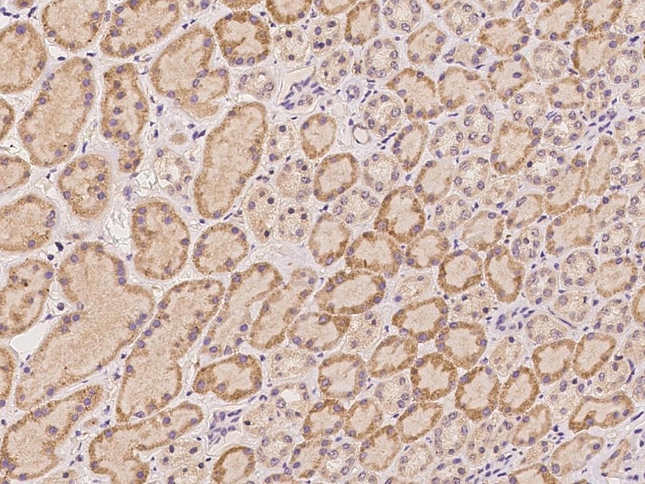 HRASLS1 / HRASLS Antibody