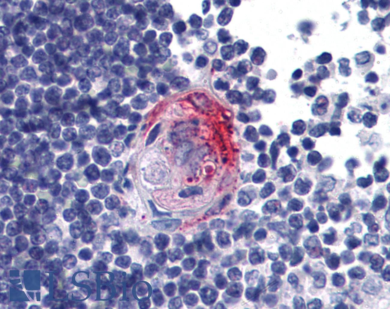 IHC-plus™ AKT2 Antibody (clone 1B6)