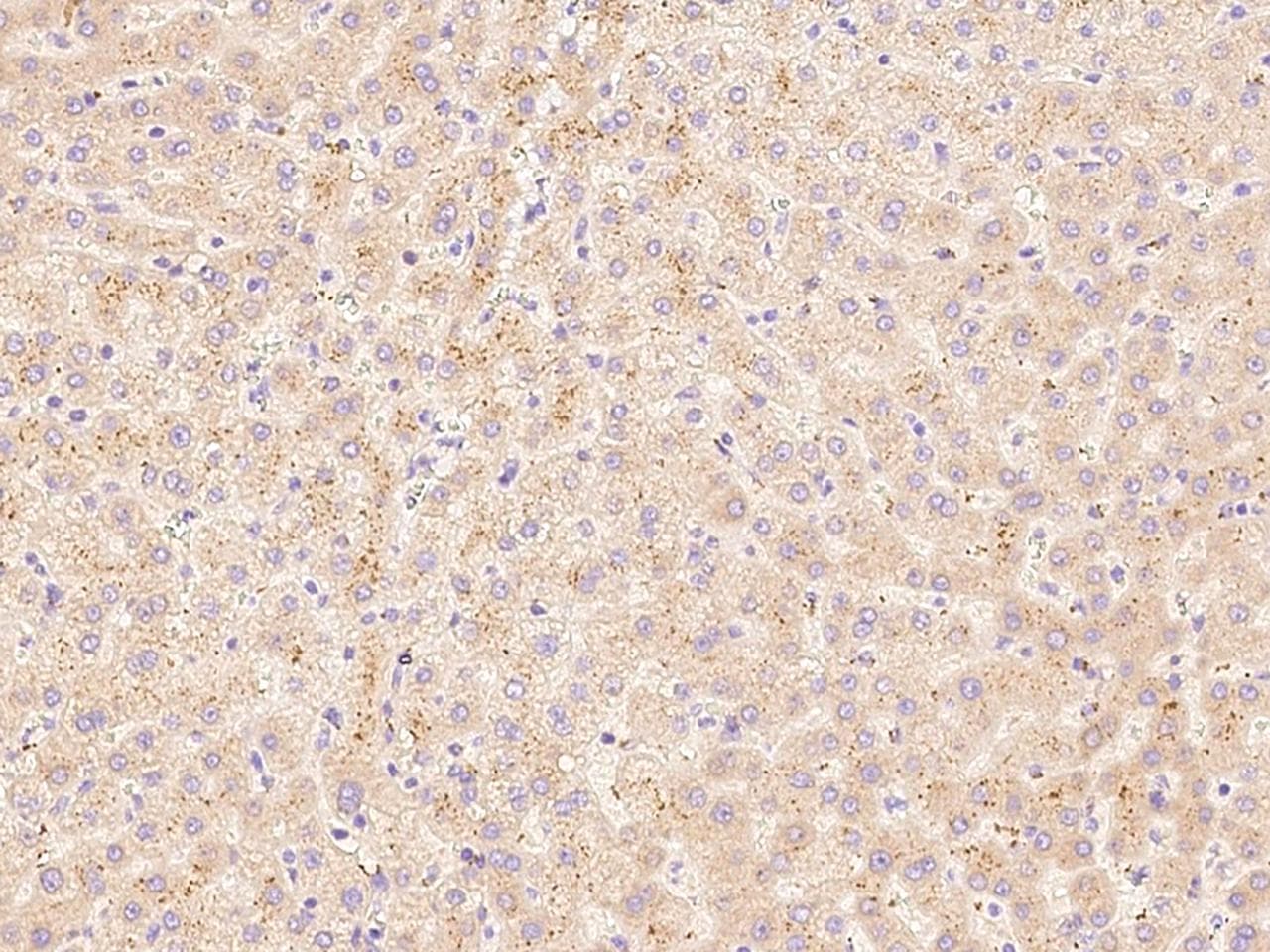 Polyclonal Rabbit anti-Human HGF / Hepatocyte Growth Factor Antibody (Preservative Free, IHC)