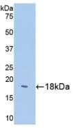 SST / Somatostatin Antibody (aa1-116)
