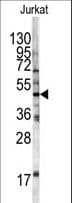 HFE Antibody (aa122-148)