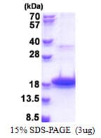 Human DEFB118 Protein (Recombinant His)