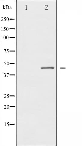 GJA1 / CX43 / Connexin 43 Antibody (phospho-Ser367)