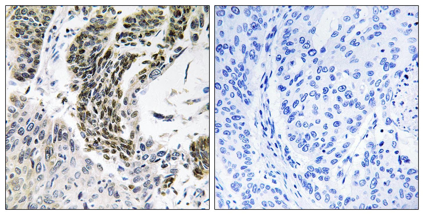 RREB1 Antibody