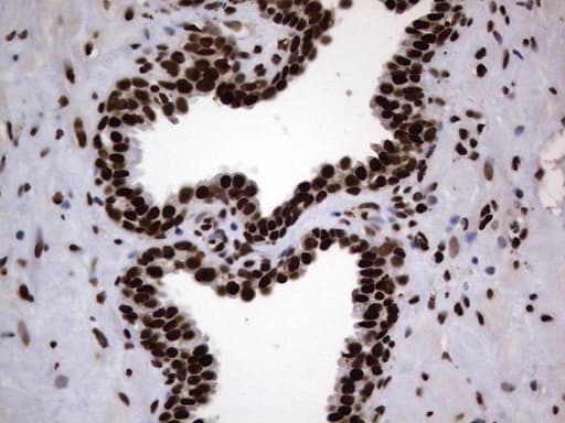 HNRNPL / hnRNP L Antibody (aa270-502, clone OTI2E4)