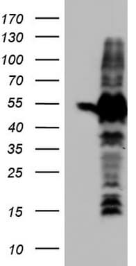 SETD2 Antibody (aa1787-2144, clone OTI3G8, Carrier-free)